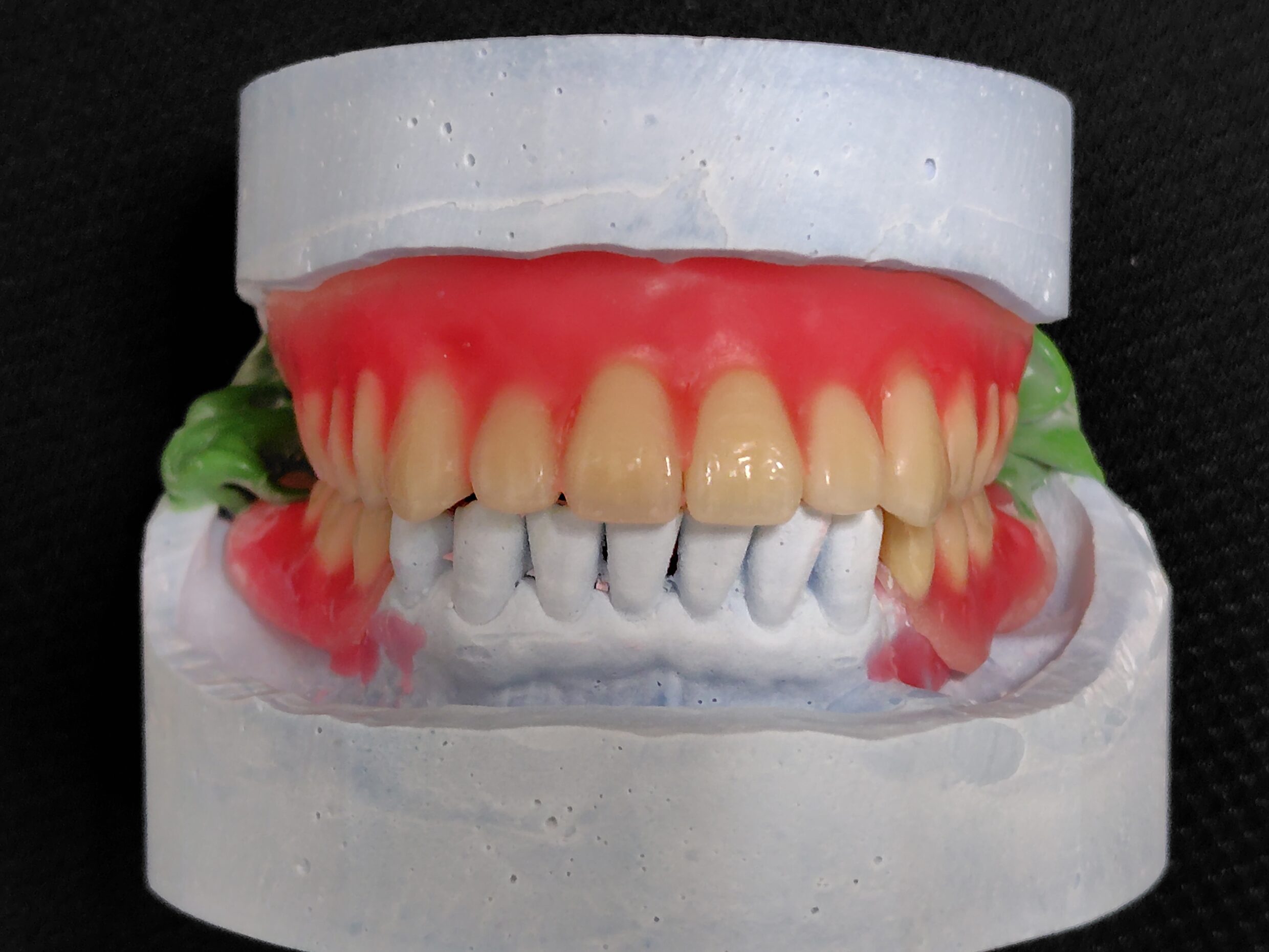 咬合器の上に、上下の歯を並べたところ