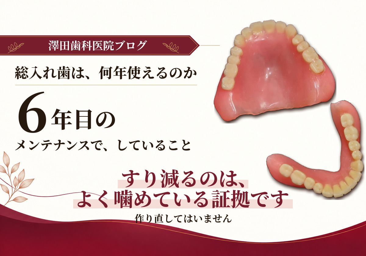 6年目のメインテナンス。奥歯がすり減るのは良く噛めているから