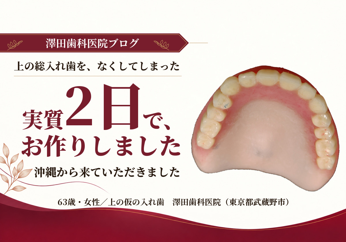上の総入れ歯をなくしてしまった患者さん。急ぎの義歯を実質２日で作りました。沖縄から来院。